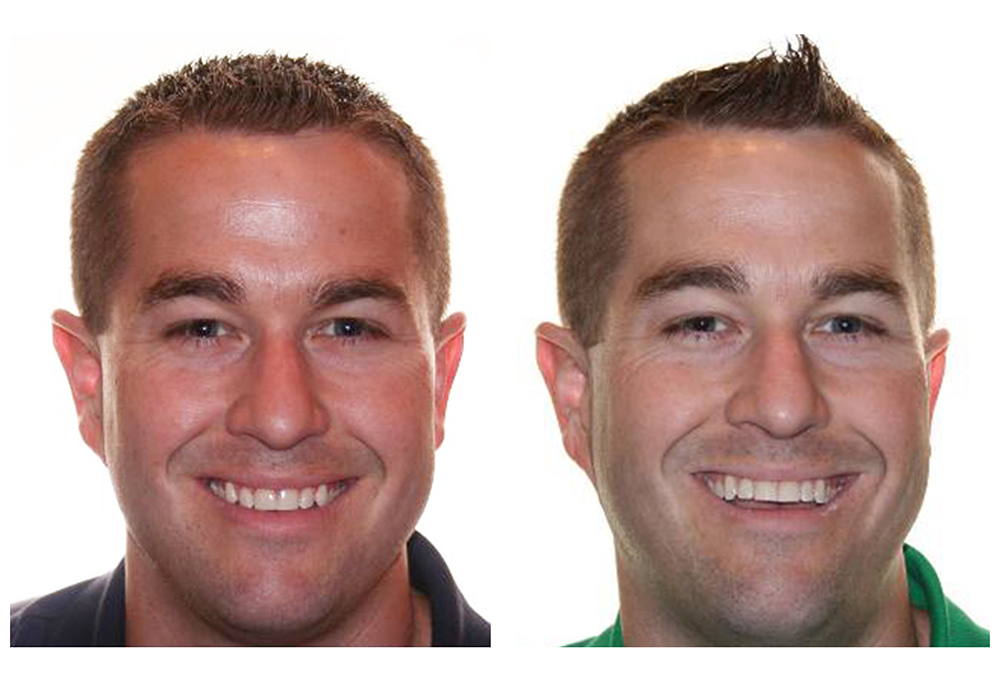 Allatoona Family Dental