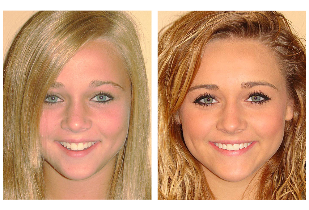 Allatoona Family Dental